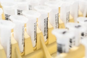 test tubes with barcoded labels